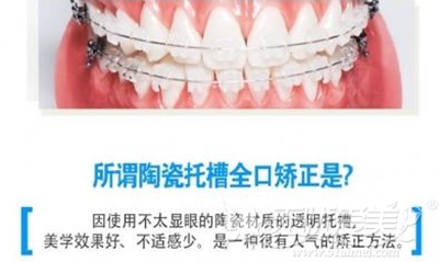 20170710035125730.jpeg
